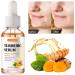 Turmeric Serum for Dark Spots Removal Turmeric Dark Spot Corrector Serum for Face & Body Turmeric Oil Age Spot Corrector Skin Care Moisturizing Serum - Buy Online on GoSupps.com