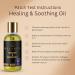 Healing & Soothing Essential Oils for Itchy Dry Skin | Restorative Body Oil with Vitamin E Argan & Jojoba | Moisturizing Skincare for Adults & Kids - Buy Online on GoSupps.com