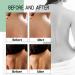 Herbaluxy Back Acne Treatment Spray - 2% Salicylic Acid for Effective Body Acne Relief | Fast International Shipping - Buy Online on GoSupps.com