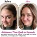 Silk Base Real Human Hair Topper for Thinning Hair Women - Medium Auburn Brown (6#) 12inch - Buy Online on GoSupps.com