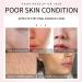 Face Primer Pore Base Gel Cream for Invisible Pores Face Primer Cream Pore Base Gel Anti-oxidation Foundation Makeup - Buy Online on GoSupps.com