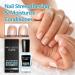 15 ml OnycholysisHeal Nail Strengthener and Growth Conditioner Cuticle Care Oil Nail Strengthener for Damaged Nails Nail Strengthener and Growth Agent for Damaged Nails (1 Piece) 1 piece. - Buy Online on GoSupps.com