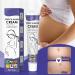 Bploar 2 Pieces Stretch Mark Cream Anti Stretch Mark Cream Stretch Mark Repair Cream Gentle Moisturizing Cream for Stretch Mark Prevention and Treatment 1 - Buy Online on GoSupps.com