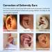 Sanfe Elephant Protruding Ear Corrector - Orthopedic Baby Item for Newborns - Pinna Locator for Large Ear Correction - Buy Online on GoSupps.com