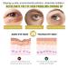 Retinol Eye Cream & 24k Under Eye Patches Kit - Anti-Aging Dark Circles & Puffy Eyes Treatment - Moisturizing & Firming Formula - Buy Online on GoSupps.com