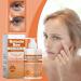Skin whitening cream facial moisturizing cream 100 g gel intensive care for pigment spots irregularities and dryness for daily use - Buy Online on GoSupps.com