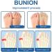 Ortho Bunion Relief Socks Set - 5 Pairs for Women | Align Toe Socks for Foot Health and Antibunions | Black - Buy Online on GoSupps.com