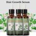 Hair Growth Serum - Thicker Longer Fuller Hair | Prevent Hair Loss & Thinning | Vitamin-Rich Natural Treatment - Shop Now - Buy Online on GoSupps.com