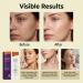 Gel Hydratant Visage | Soin Gel Visage Anti-Imperfections Non Collant | Soin Traitant pour le Corps Pour Voyage d'Affaires Maison Ext rieur cole Hommes Femmes  - Buy Online on GoSupps.com