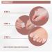 RooRuns 4 Pack White Gel Toe Separators for Overlapping Toes - Hammer Toe Straightener & Bunion Pads Corrector | Pinky Toe Spacers for Bunion Relief - Women's Foot Care Kit - Buy Online on GoSupps.com