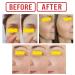 Vitamin C Under Eye Serum for Puffy Eyes, Dark Circles & Wrinkles - 1 Fl Oz - Buy Online on GoSupps.com