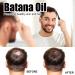  Orgrul Set of 3 organic batana oils for hair growth - Rosemary Organic Natural Hair Growth Oil - Promotes healthy hair in men and - Buy Online on GoSupps.com