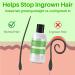 LAVO Tea Tree Gel with Salicylic Acid - Ultimate Ingrown Hair Treatment for Men and Women - Razor Bump and Burn Remover - Ideal for Bikini Lines, Acne, and Post-Hair Removal - Waxing, Shaving, Laser, Electrolysis - Buy Online on GoSupps.com