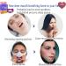 Mouth Tape For Sleeping Quit Mouth Breathing Device Anti Snoring Promotes Nasal Breathing Adhesive Non Woven Fabric Cute Pattern Large Size For Adults 30 Sheets For 30 Days Supply 30 Sheets Forming A New Habit Large Size for Adults - Buy Online on GoSupps.com