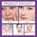 Dark Spot Correcting Glow Serum Dark Spot Repair Essence Lotion - Brightening & Moisturizing Korean Skincare Anti-Hyperpigmentation Treatment Anti-Aging Fine Lines & Circles - Buy Online on GoSupps.com