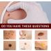 Skin Tag & Moles Remover Pen - Quick and Easy Wipe Off Solution for All Skin Types - Buy Online on GoSupps.com