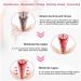 AnnieCare Instant Anti-Itch Detox Slimming Products - Natural Viginal Gel & Capsules (10Box) - Buy Online on GoSupps.com