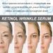 Retinol Serum for Face 37ml - 0.4% Japan Retinol Serum High Strength for Face with Vitamin C Hyaluronic Acid Anti Aging Face Serum for Women Acne Scar Dark Spot Fine Line and Wrinkles - Buy Online on GoSupps.com