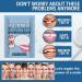 Depri Playlist Plastic Teeth Glue - Best Temporary Denture Adhesive for Broken Teeth & Fillings | One Size Fits All - Buy Online on GoSupps.com