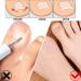 Nail Repair Patches Toenail Patches Ingrown Toenail Treatment Broken Nail Repair Toenail Stickers Toenail Corrector Patch Toe Nail Correct Stickers Comfortable Correction Patch Stickers For Toenail - Buy Online on GoSupps.com