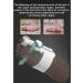 Vduck Bunion Corrector - Medical Quality Big Toe Straightener with Silicone Pads for All-Day Relief - White - Buy Online on GoSupps.com