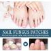 Fungal Nail Treatment - Extra Strong Nail Fungus Treatment for Toenail and Fingernail - Fungal Nail Eliminator Anti fungus Nail Repair and Strengthen Fix & Renew Damaged Broken Nails 30ml - Buy Online on GoSupps.com