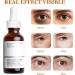 Caffeine Solution 5% + EGCG Caffeine & Hyaluronic Acid Under Eye Serum Caffeine Eye Serum Under Eye Cream for Reduce Circles and Puffy Eyes Eye Bags and Fine Lines Anti Aging Wrinkle - Buy Online on GoSupps.com