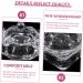 Zerodeko Diamond Decor Candy Jar Nail Art Accessories Glass Nail Dish with Lid Acrylic Nail Tools Nail Dish Cup Manicure Nail Dish Dappen Dish Glass Nail Cup Glass Jar Wedding 1 - Buy Online on GoSupps.com