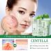 Centell Skincare Sets | 6-in-1 Teen Skin Care Kit | Complete Facial Care for Oil Control | Perfect Skincare Gift Set for Girls | Soothing & Hydrating Formula - Buy Online on GoSupps.com