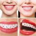 Tartar Jewelry 16PCS Set - Crystal Tooth Decorations & Gemstone Ornaments for Men & Women | Stunning Dental Gems - Buy Online on GoSupps.com