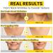 Chillihaer 8-in-1 Radiant Neck Firming Cream, Tighten and Lift Neck Wrinkle Cream, Collagen Retinol Face and Chest Firming Tightening for Women and Men with Sagging Crepey Skin Over 50 & 60 - Buy Online on GoSupps.com