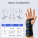 FREETOO Adjustable S-shaped Wrist Support Brace for Men and Women - Carpal Tunnel, Arthritis, RSI, Sprain & Fracture Relief - Rose Red (Large, Right Hand) - Buy Online on GoSupps.com