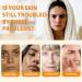 Kojic Acid & Turmeric Cleansing Pads Kojic Acid And Turmeric Pads Turmeric Exfoliating Pads For Fades Dark Spots Face Exfoliator Pad Helps Balance Oil And Water - Turmeric Kojic Acid Face Pads - Buy Online on GoSupps.com