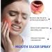 Mouth Ulcer Spray Ulcer Breath Sprays Mouth Ulcer Treatment Spray Ulcer Treatment Canker Sore Treatment Canker Relief Spray Oral Ulcer Sprays Herbal Mouth Spray Dry Mouth Relief Treat Mouth Ulcer - Buy Online on GoSupps.com