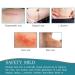 Meinuo Silicone Scar Sheets - Roll Scar Tape for Safe & Painless Scar Removal - 1.6 x 120 - Ideal for Body, Burn, C-Section, Keloid, Acne, Surgery - Buy Online on GoSupps.com