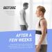Portzon Posture Corrector for Women and Men - Breathable X-Large Upper Back Straightener for Neck and Shoulder Pain Relief - Buy Online on GoSupps.com