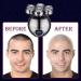 Men's 7D Bald Head Shaver | Wet/Dry Electric Razor with Anti-Pinch Technology | Wireless Charging Base | 2 Shaving Heads - Buy Online on GoSupps.com