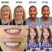 Perfect Smile Dentures Pebbles - Cosmetic Veneers & Temporary Prostheses for Men & Women | 6 Pairs of Reusable Tooth Whitener - Buy Online on GoSupps.com
