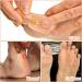 20 PCS U-Shaped Felt Callus Pads - Metatarsal & Forefoot Cushion for Foot Pain Relief & Protection from Rubbing - Self-Adhesive Foot Care - Buy Online on GoSupps.com