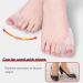 DAPIN Bunion Corrector 6 Pack - Toe Straightener, Separator & Protector Set for Bunion Relief - Buy Online on GoSupps.com
