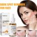 Turmeric Facial Essence Dark Spot Removal Brightening Oil Serums Natural Moisturizer Power Repairing Conditioner 101 Fl Oz Facial Moisturizing Essence for Dry Qihuyi - Buy Online on GoSupps.com