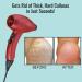 SaxVon Electric Foot Callus Machine - Professional Foot Care Tool - Buy Online on GoSupps.com