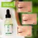 Collagen Serum 30ml - Clinical Skincare from London UK | Ideal for Micro Needle Derma Roller & Stamp - Buy Online on GoSupps.com