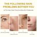 50% Citric Acid Peeling Serum for Face | Skin Peel Solution for Dark Spots & Acne | Exfoliating Chemical Peel 30ml - Buy Online on GoSupps.com
