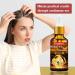 Trendyfave Hair Growth Oil Ginger Hair Growth Serum Anti Hair Loss Essence Hair Oil for Dry Damaged Hair Biotin Hair Serum for Hair Growth for Fast Hair Growth Nourishing Scalp for All Hair Types - Buy Online on GoSupps.com
