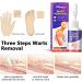 Maximum Strength Wart Remover Liquid with Salicylic Acid - Fast-Acting Wart Treatment for Common Plantar & Genital Warts - 0.68 floz/20ml - Buy Online on GoSupps.com