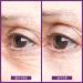 PRAI Beauty Ageless Eye Uplift Serum 15ml - Youthful Eye Treatment - Buy Online on GoSupps.com