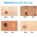Zacurate Skin Tag Remover & Wart Mole Verruca Treatment Lotion - Fast-Acting Blue Formula - 30ML (Pack of 1) - Buy Online on GoSupps.com