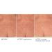 Age Defying Neck & Decollete Treatment Serum - Firm & Tighten Sagging Skin | Best Neck Wrinkle Serum - Buy Online on GoSupps.com