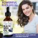 Ka Dee Black Seed Oil 4 oz - 100% Cold Pressed Unrefined & Rich in Thymoquinone | Global Shipping - Buy Online on GoSupps.com